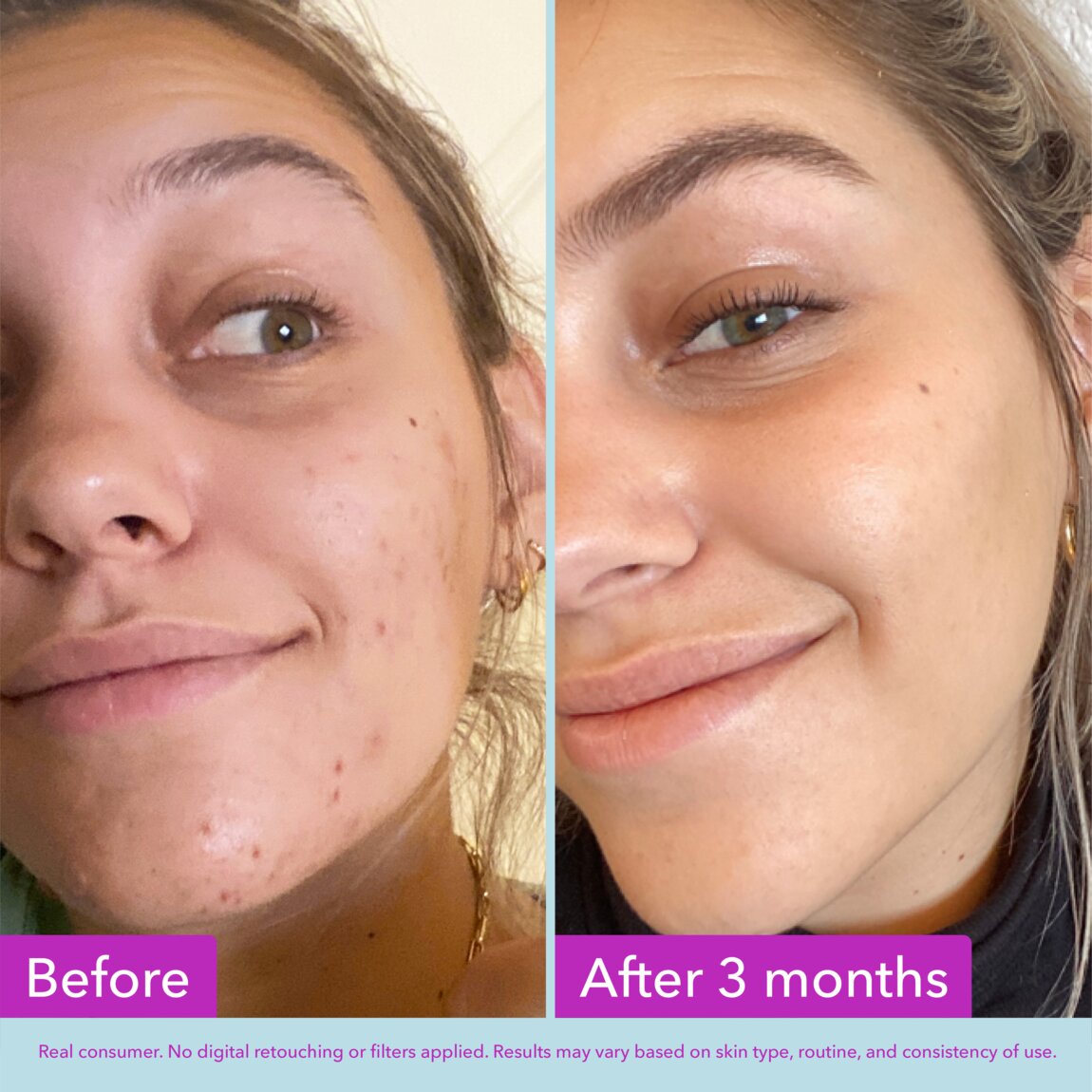 niacinamide-brightening-toner-l4 zb_p.jpg