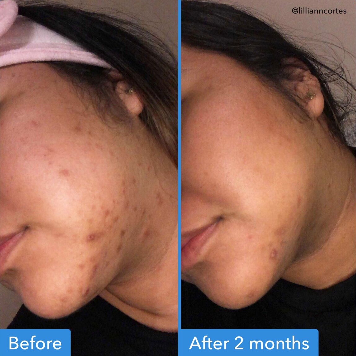 discoloration-correcting-serum-m0 zb_p.jpg